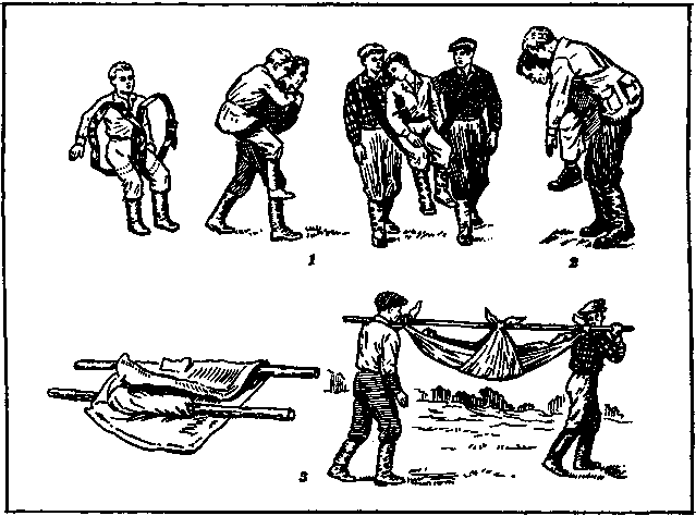 Переноска пострадавшего: 1 — на поясных ремнях, 2 — с применением рюкзака; 3 — на носилках из жердей и куртки или плащ-палатки